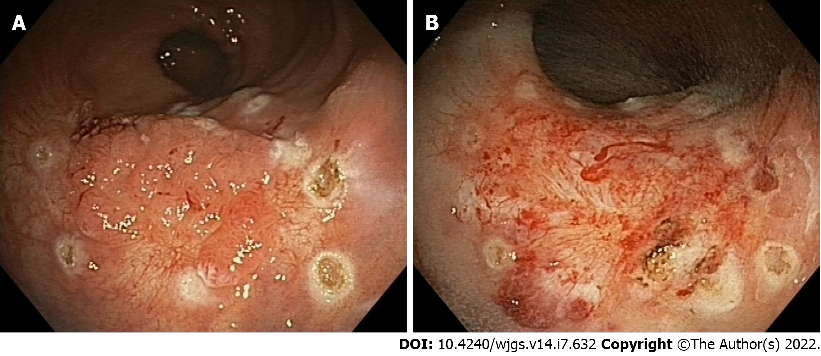 Surgical Endoscopy 7/2021