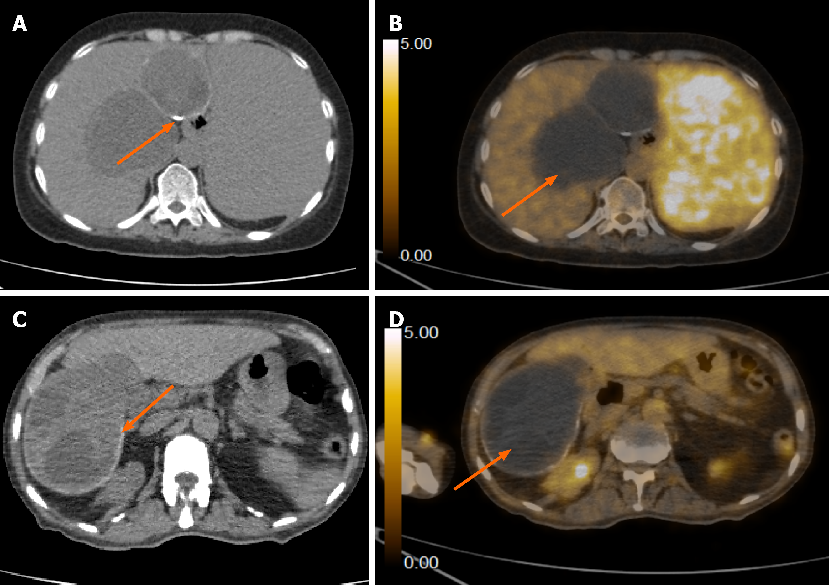 Figure 14
