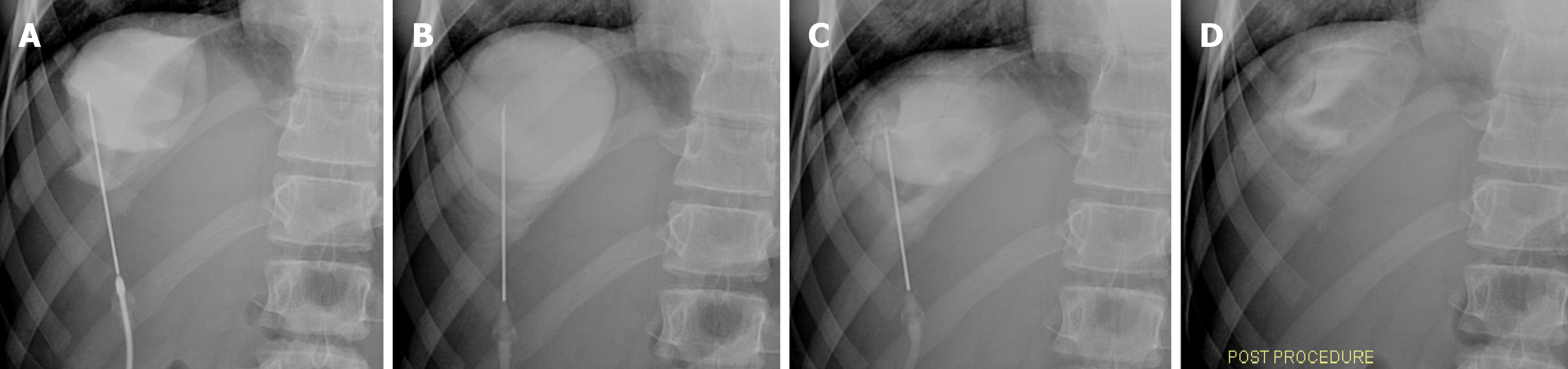 Figure 15