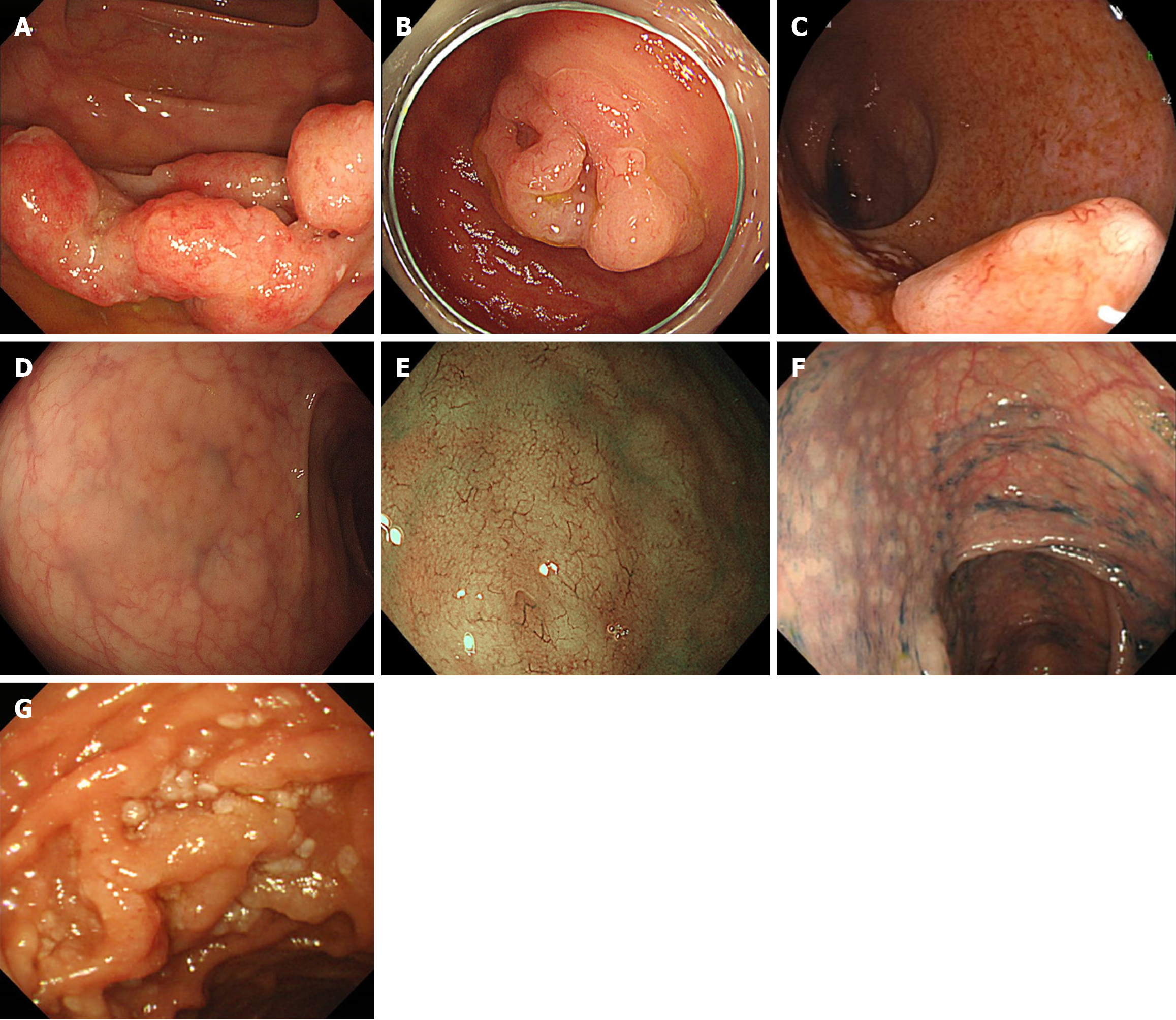 Figure 1 Figure 1