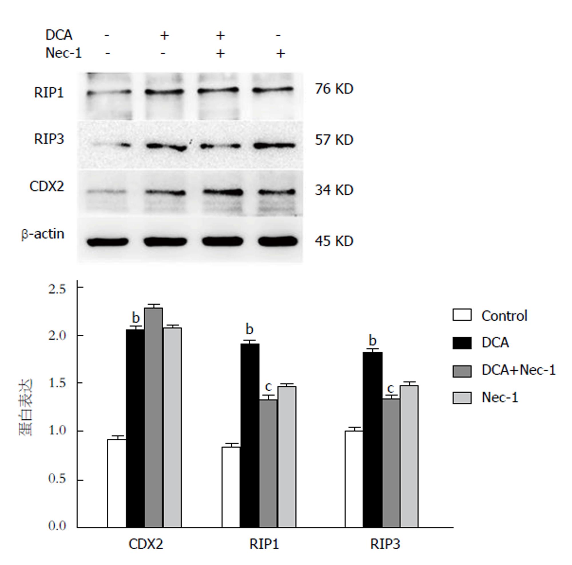 RIP3介导肠化胃上皮细胞IL-33的表达