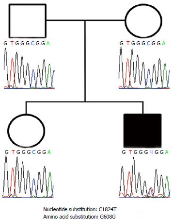 Progeria Aging Chart