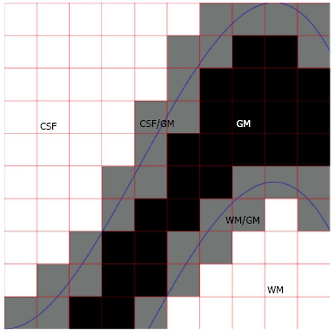 partial-volume-effect-modeling-for-segmentation-and-tissue