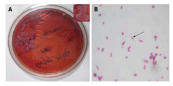 bacillus subtilis blood agar