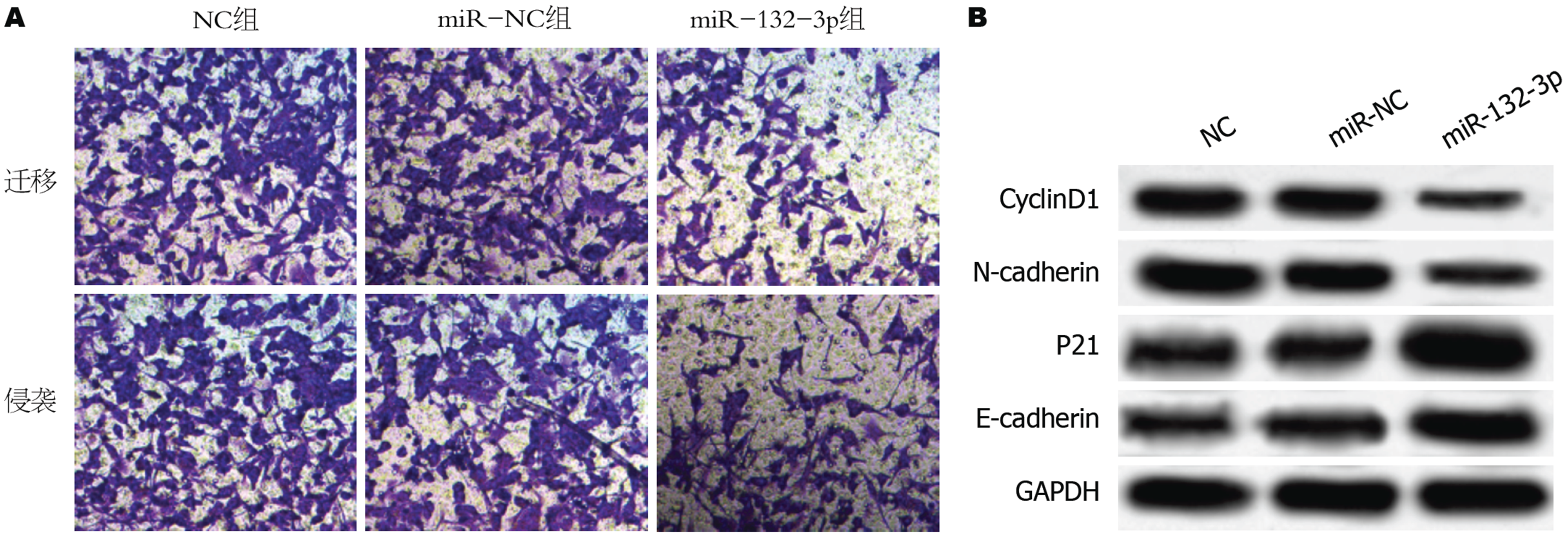 miR-132-3p靶向调控Gab2抑制胃癌细胞增殖、迁移及侵袭分子机制的研究