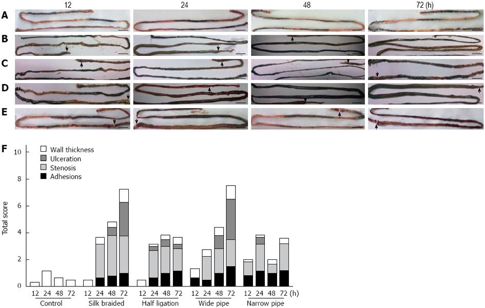 Comparison Of Different Methods Of Intestinal Obstruction In A Rat Model