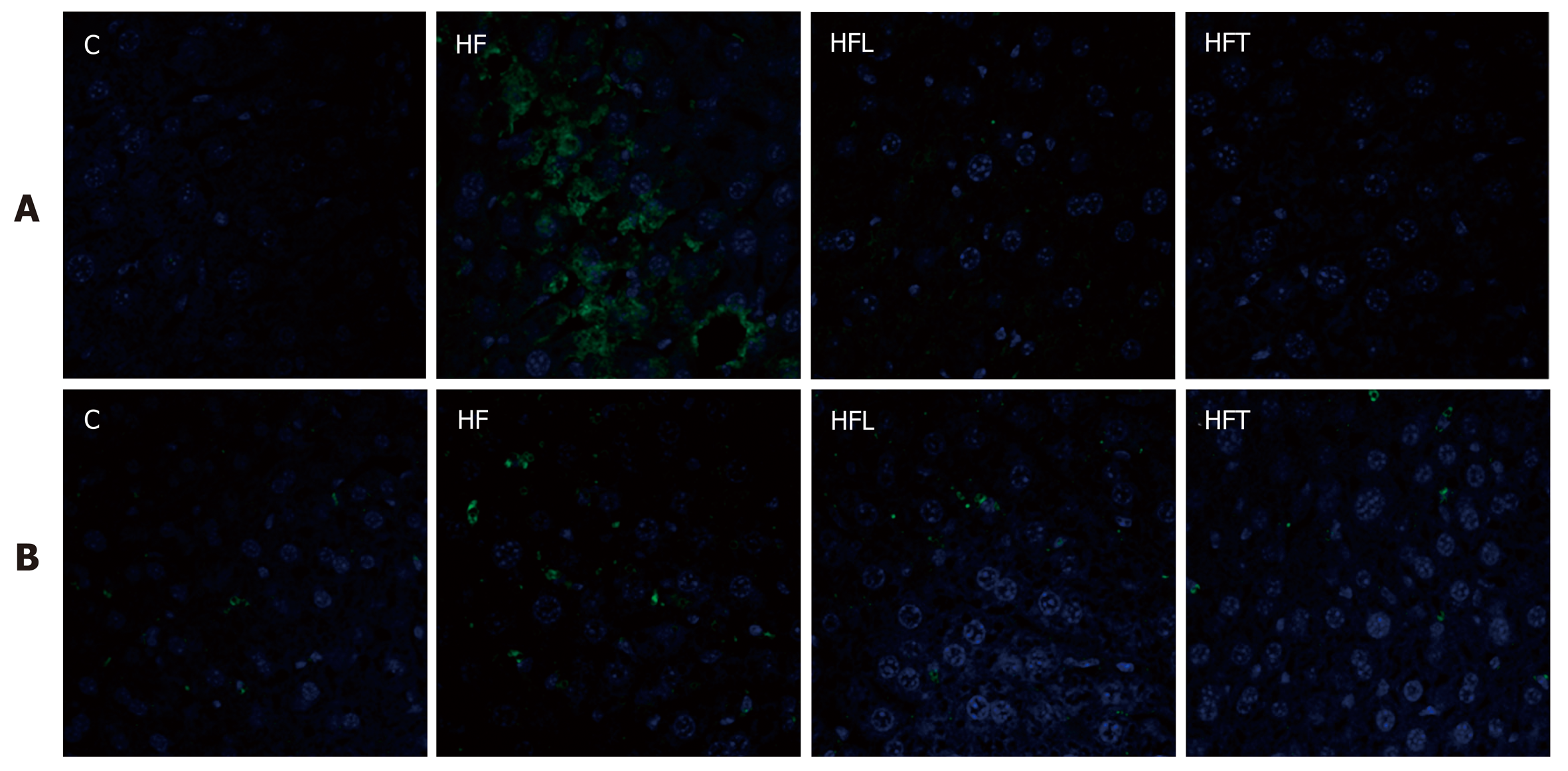 Beneficial Effects Of Losartan Or Telmisartan On The Local Hepatic Renin Angiotensin System To Counter Obesity In An Experimental Model