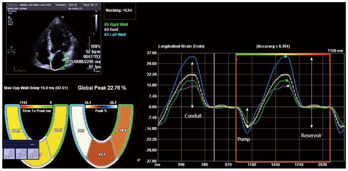 Progression of Left Ventricular Myocardial Dysfunction in Systemic  Sclerosis: A Speckle-tracking Strain Echocardiography Study