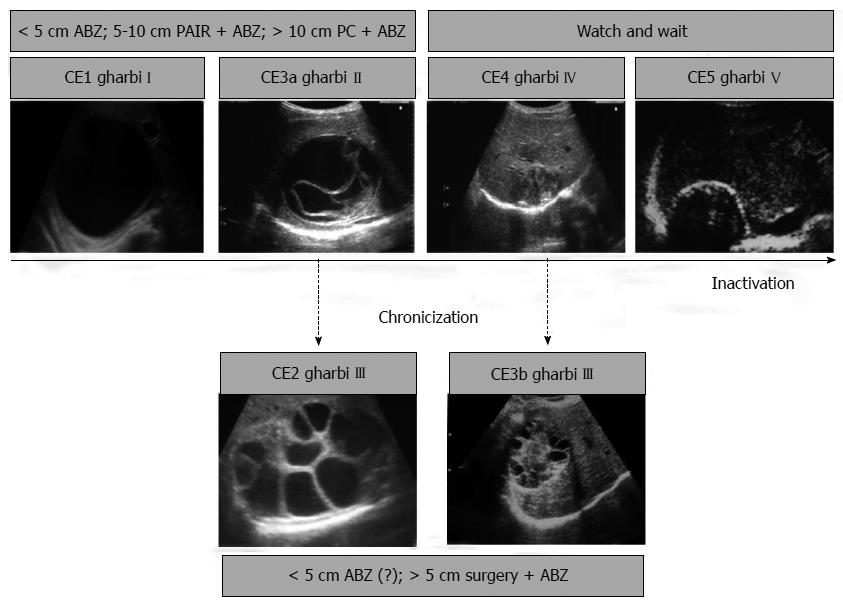 Cystic echinococcosis of the liver: A primer for hepatologists