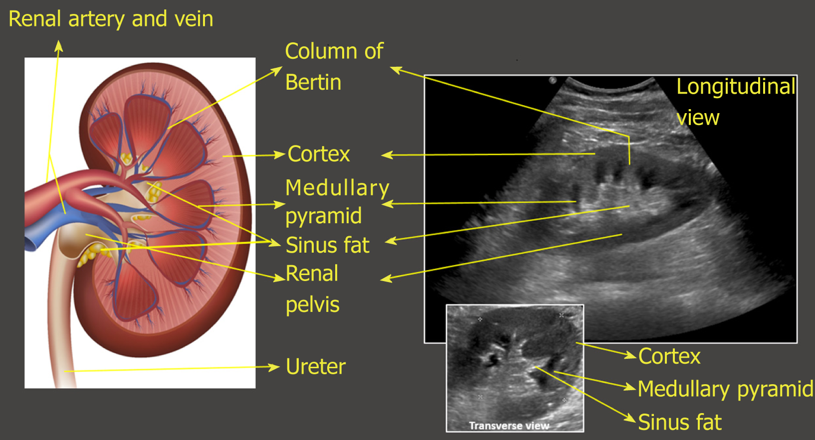 Point Of Care Renal Ultrasonography For The Busy Nephrologist A 