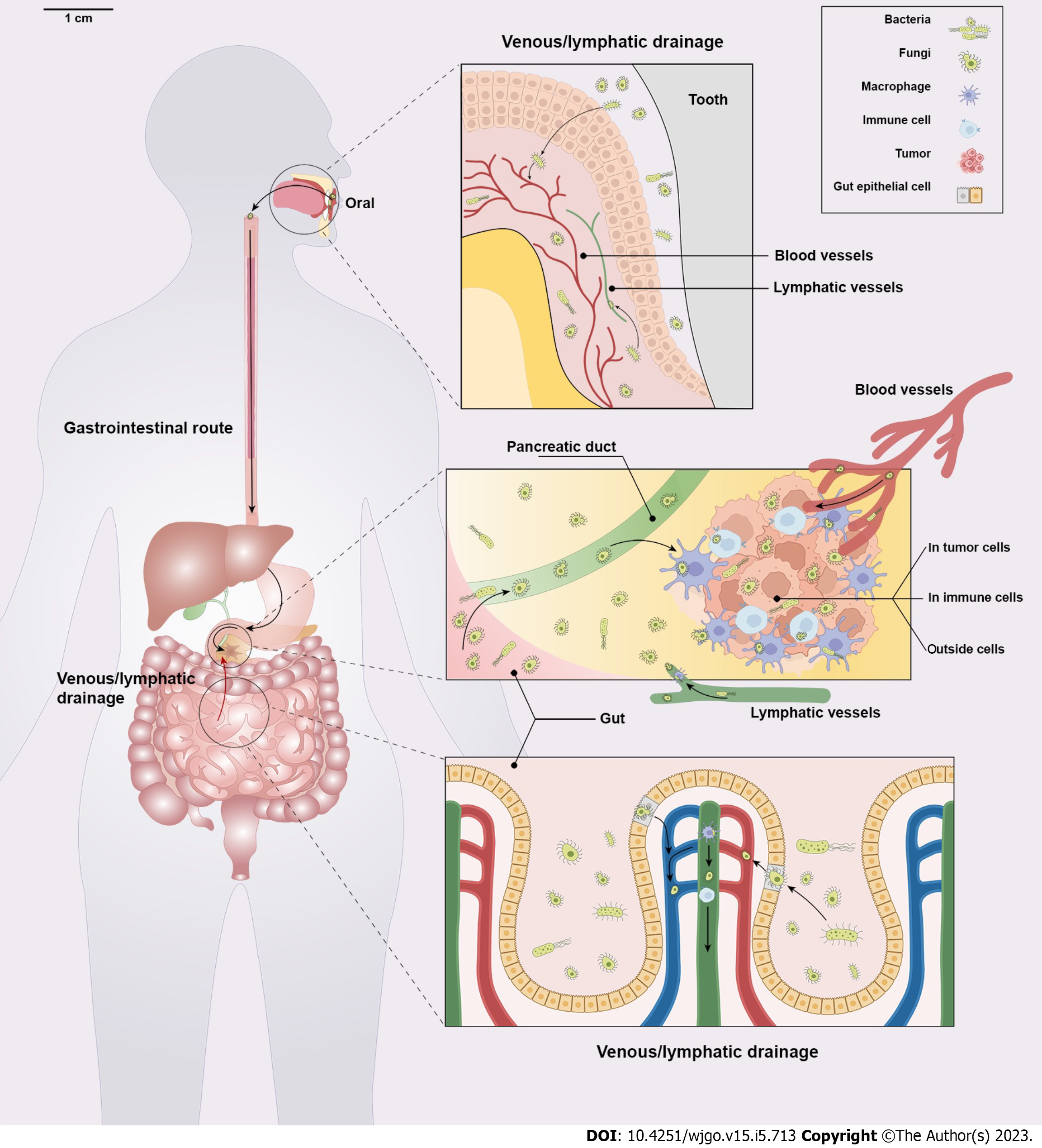 Intratumour microbiome of pancreatic cancer