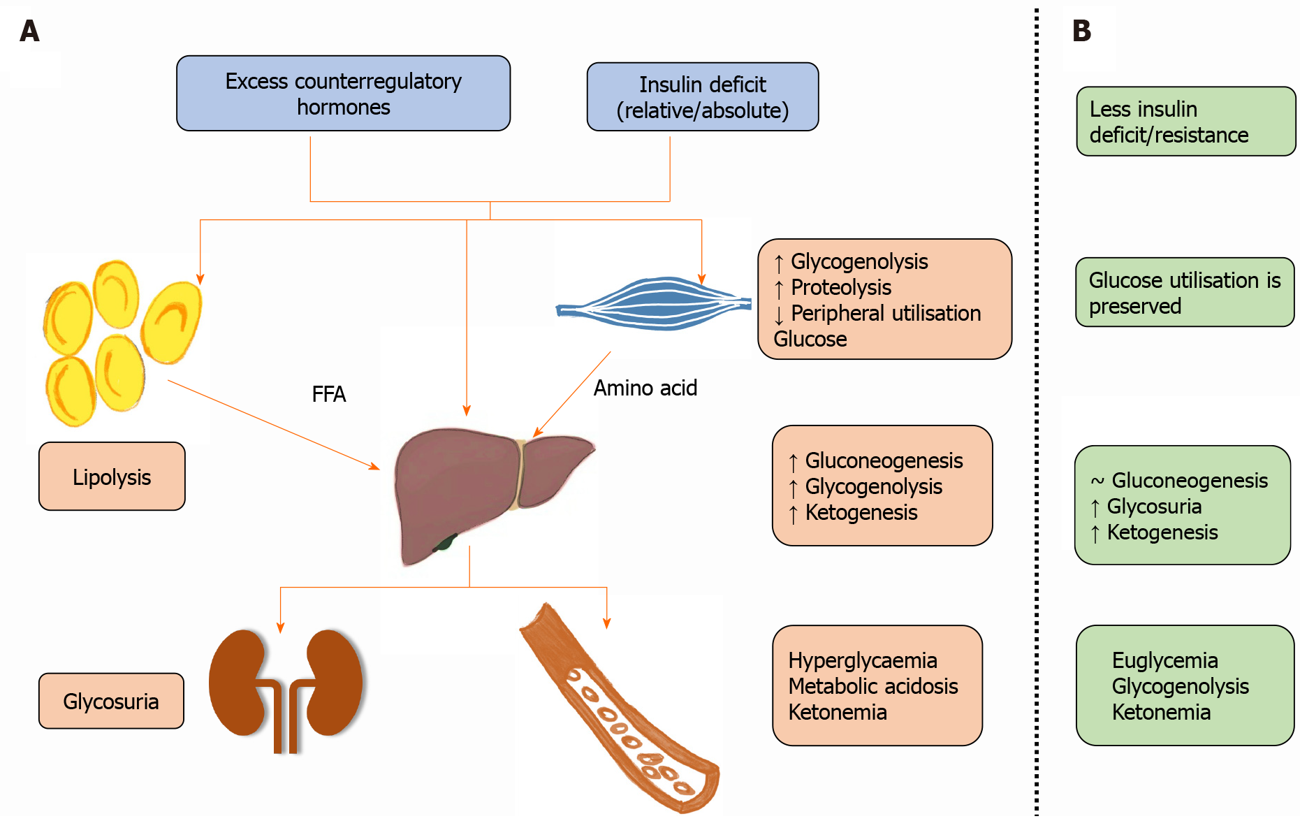 Pathophysiology Of Diabetic Ketoacidosis / Diabetic Ketoacidosis Dka