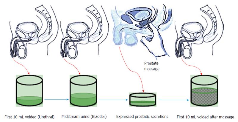 prostatitis test)