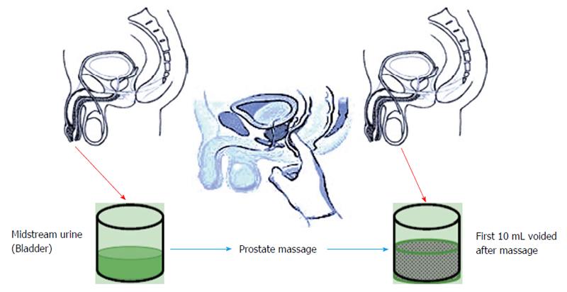 Updates on therapies for chronic prostatitis chronic pelvic pain