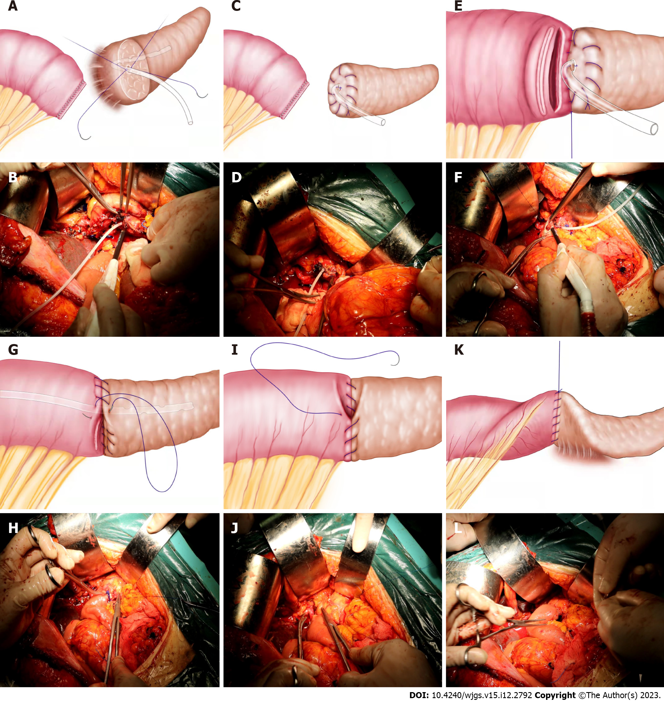 PDF) MagnetoSuture: Tetherless Manipulation of Suture Needles