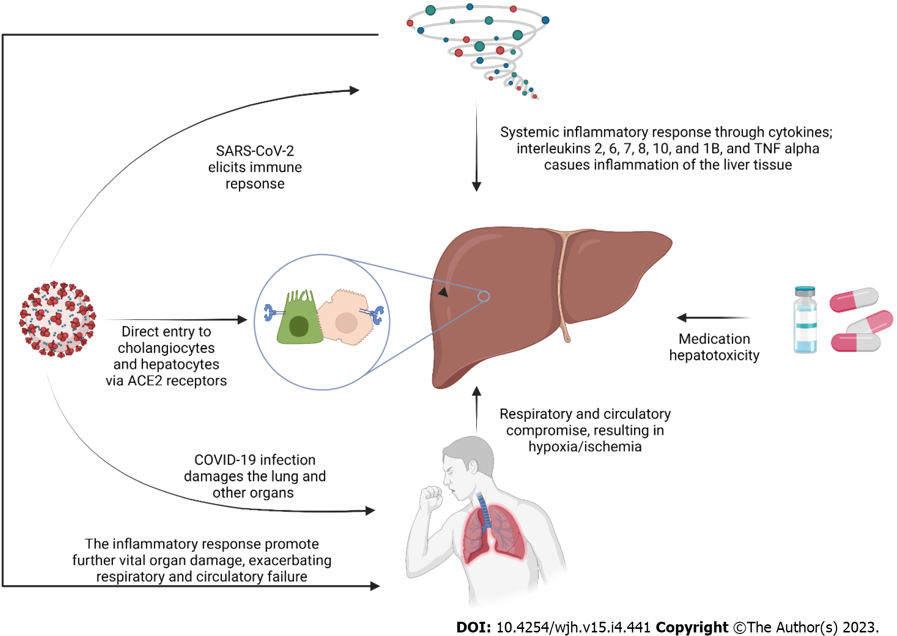 COVID-19 and liver injury Pathophysiology, risk factors, outcome and management in special populations image