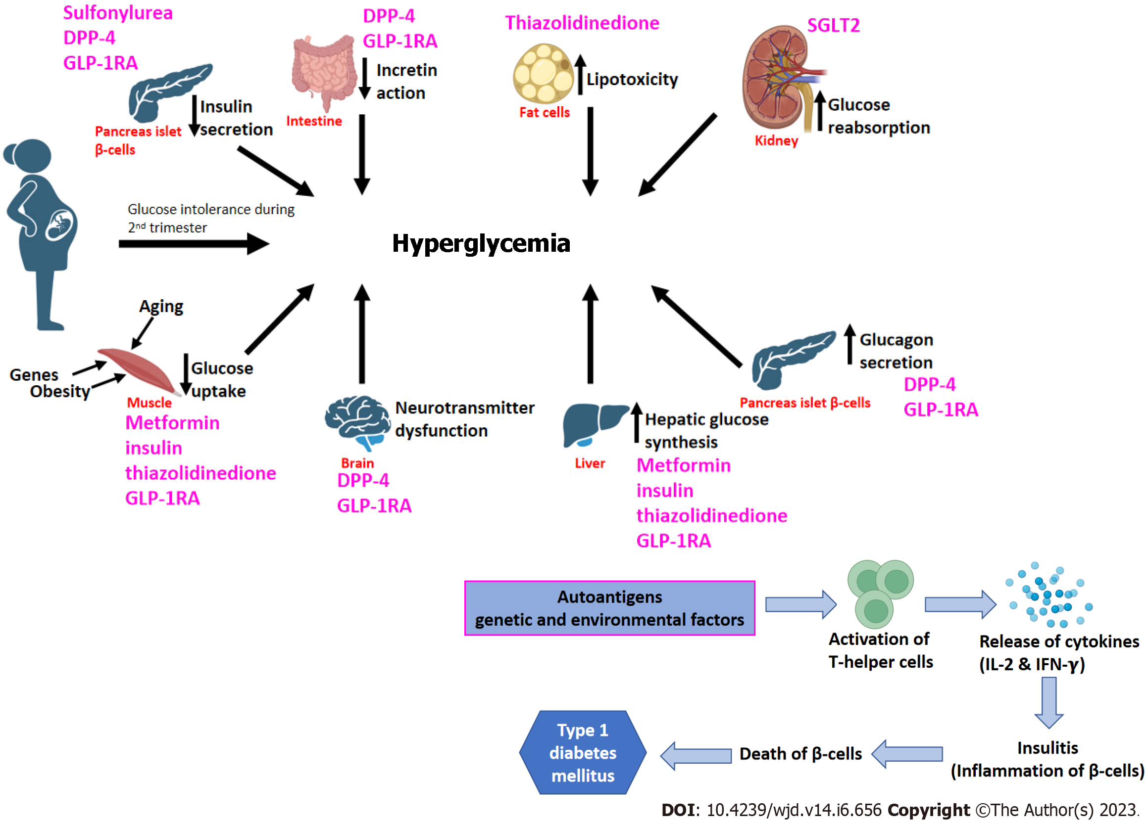 type 2 diabetes pathophysiology diagram
