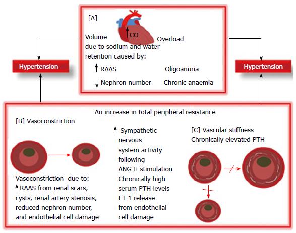 Pre treatment Considerations In Childhood Hypertension Due To Chronic 