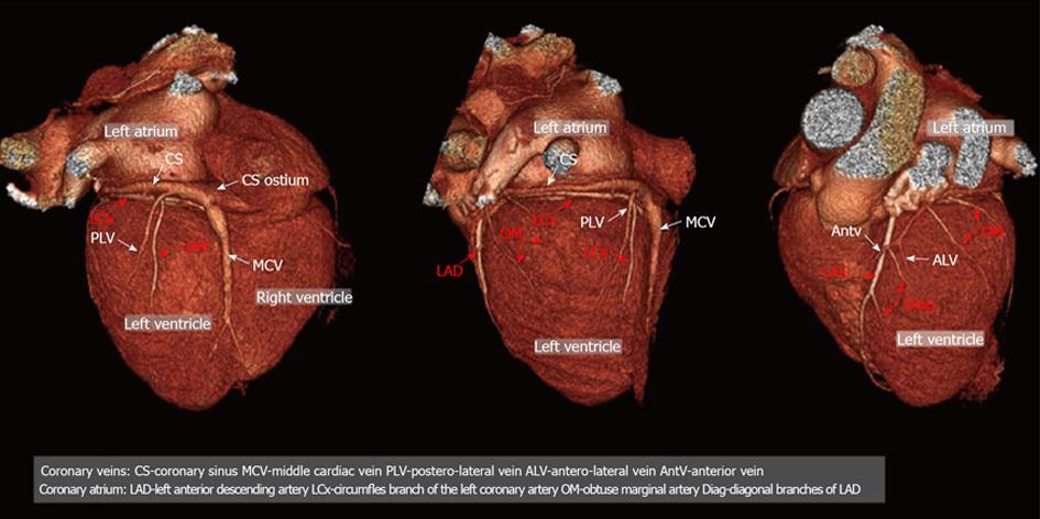 Coronary venous system in cardiac computer tomography