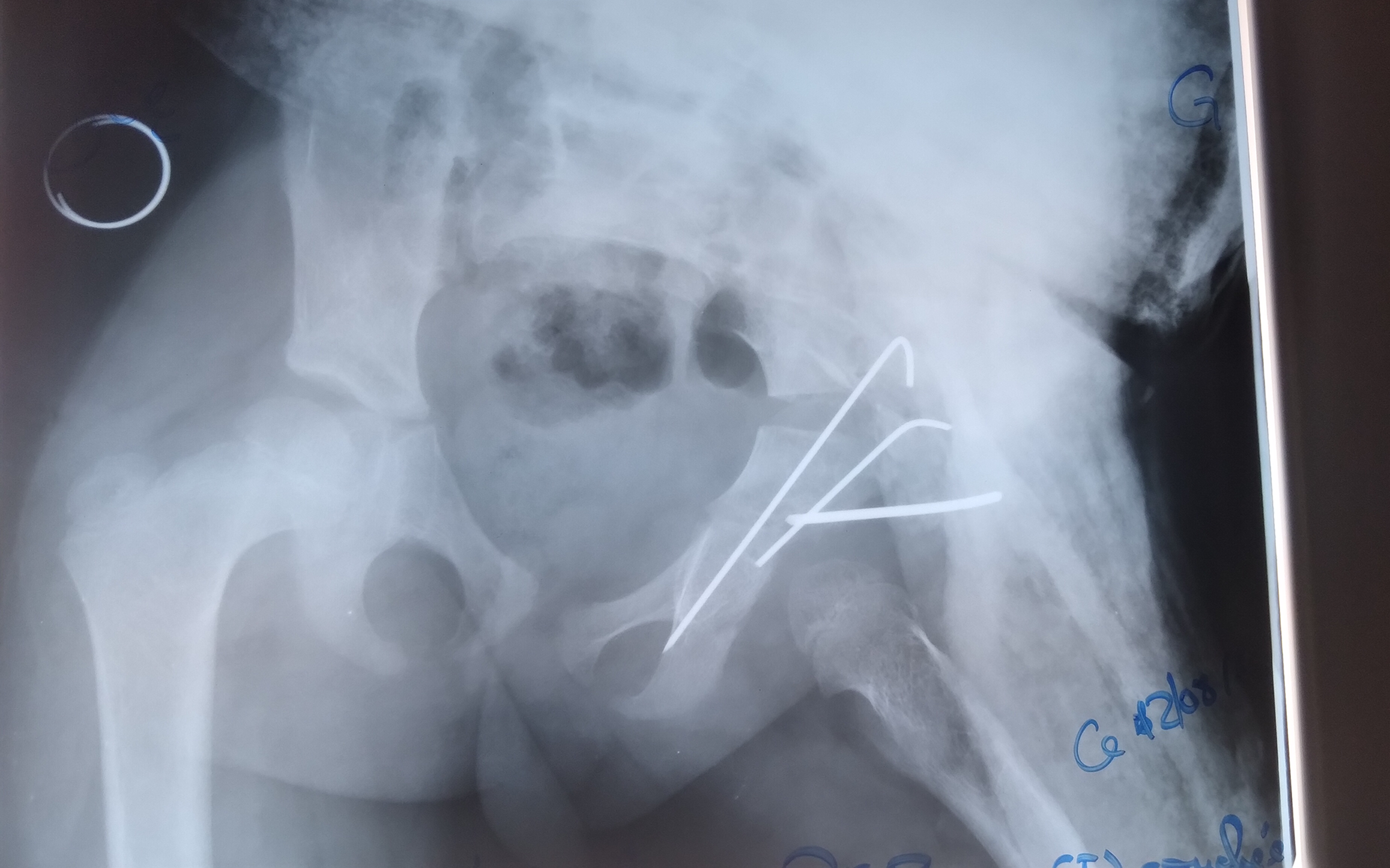 Figure 2 Figure 2
