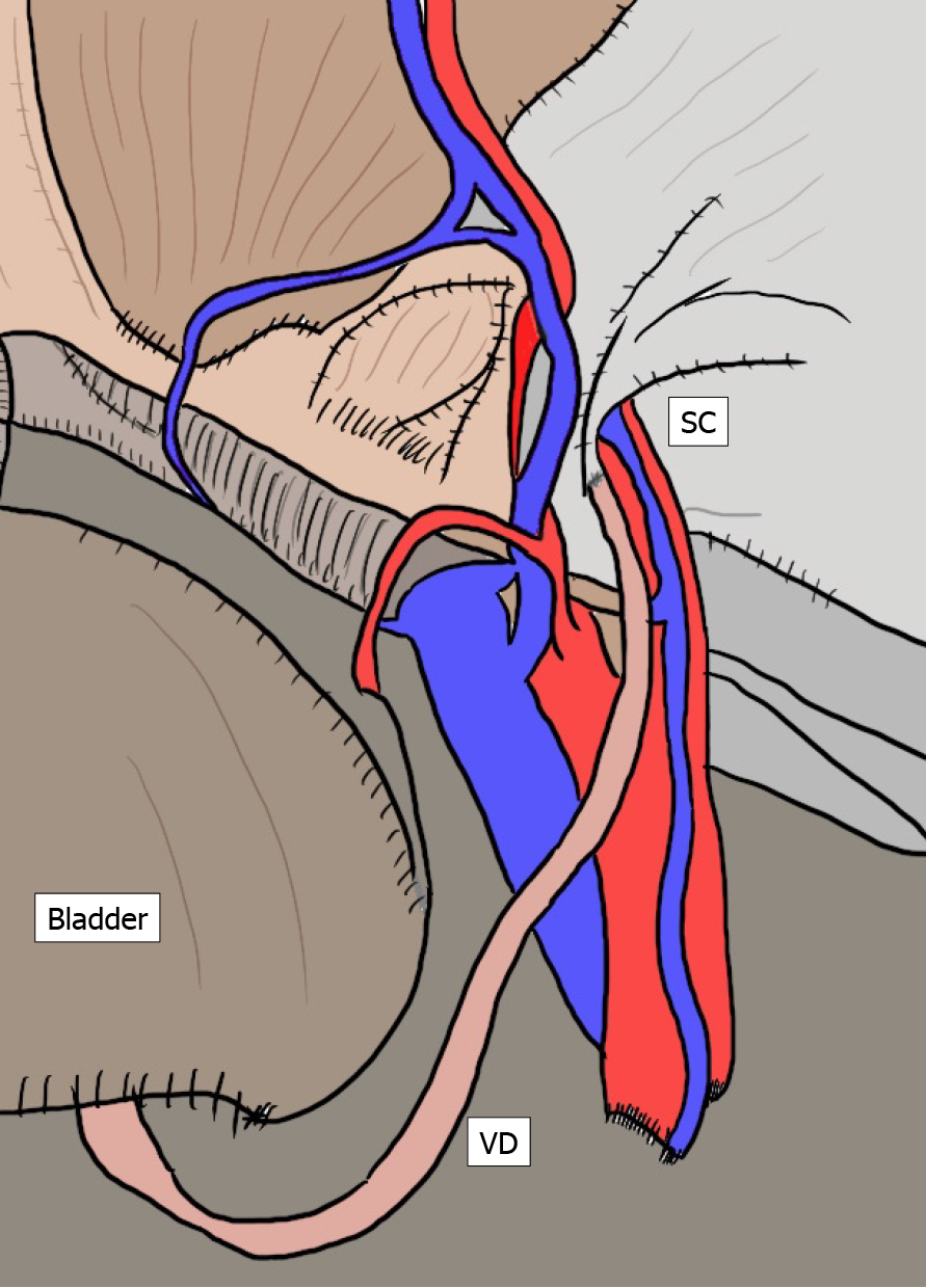 Sensory nervous distribution in the groin area. The dashed ellipse