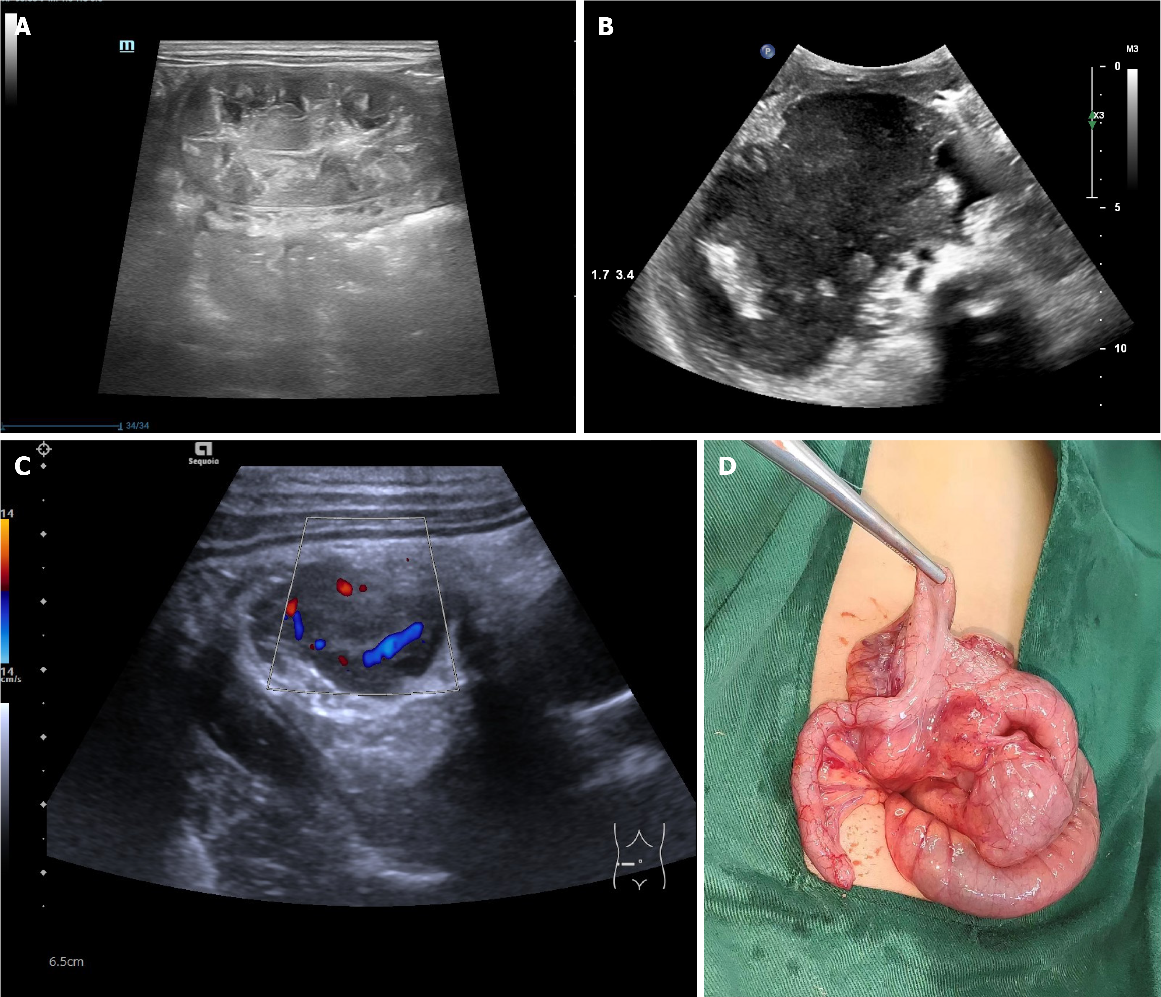 Figure 1 Figure 1