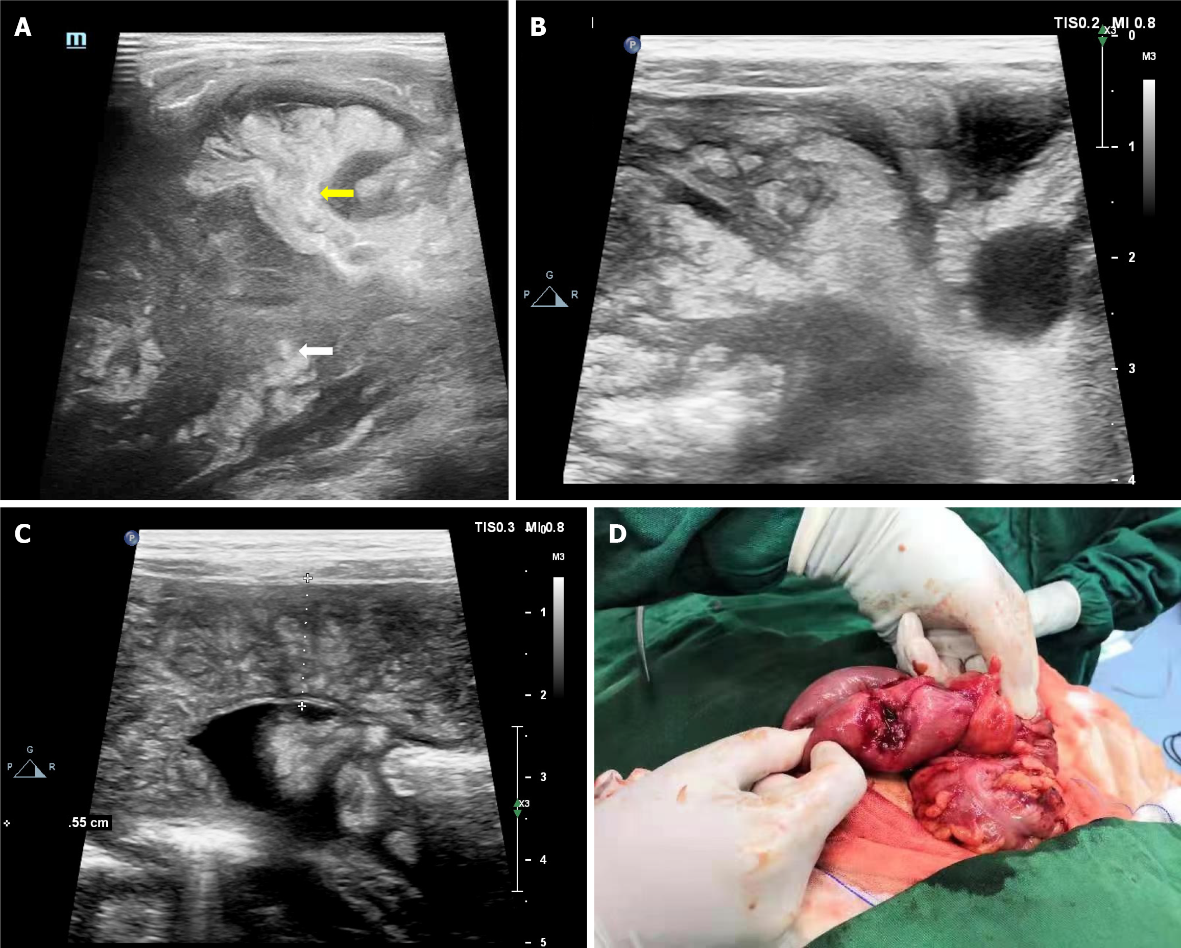 Figure 2 Figure 2