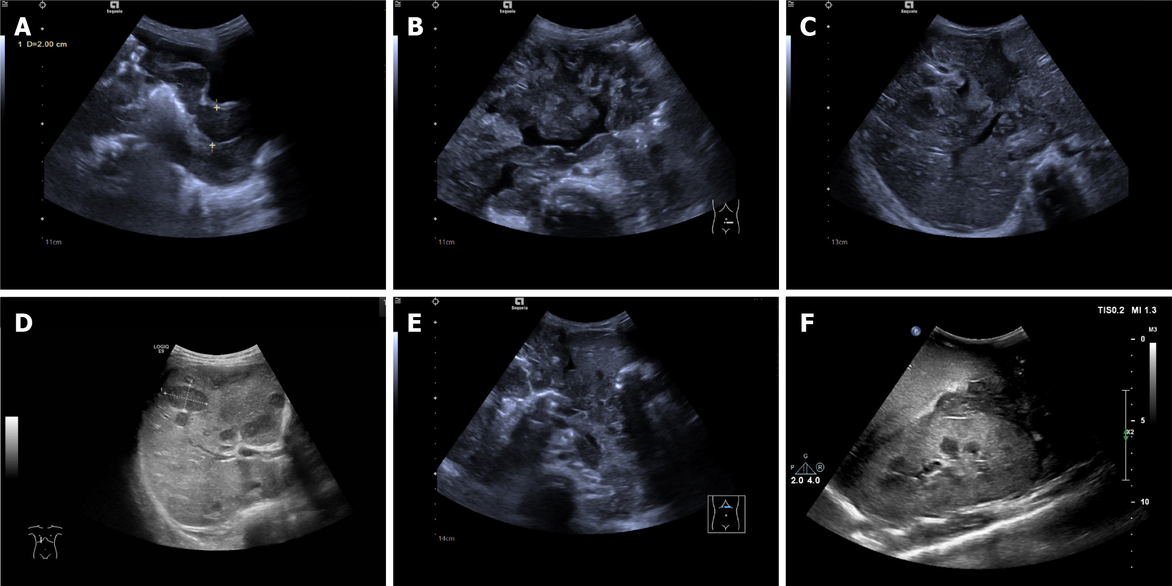 Figure 3 Figure 3
