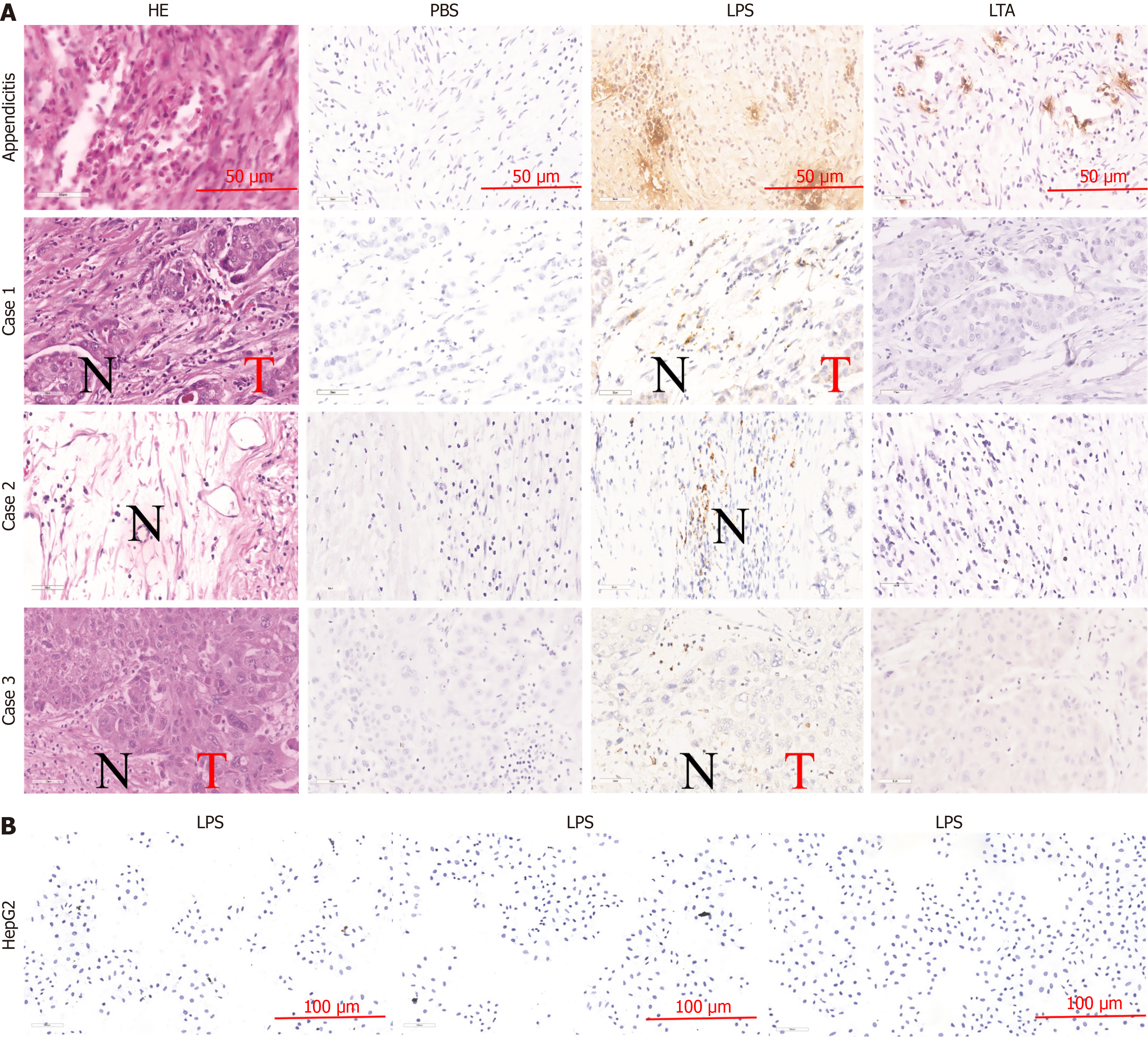 Gram-negative bacteria and endotoxins promote hepatocellular