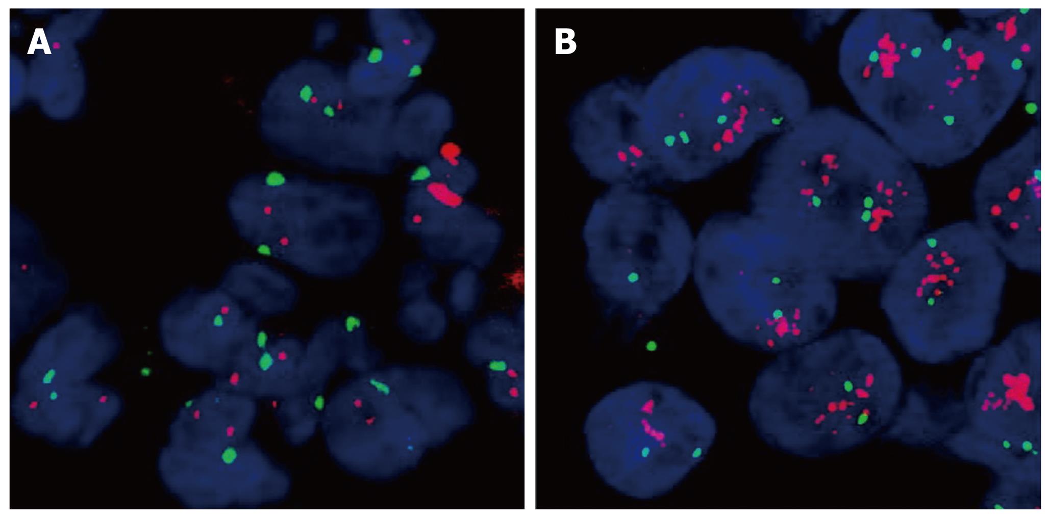 Her 2 new 3. Амплификация her2. Her2 транслокация. Her2 Gene Amplification scheme. Исследования her2 Fish.