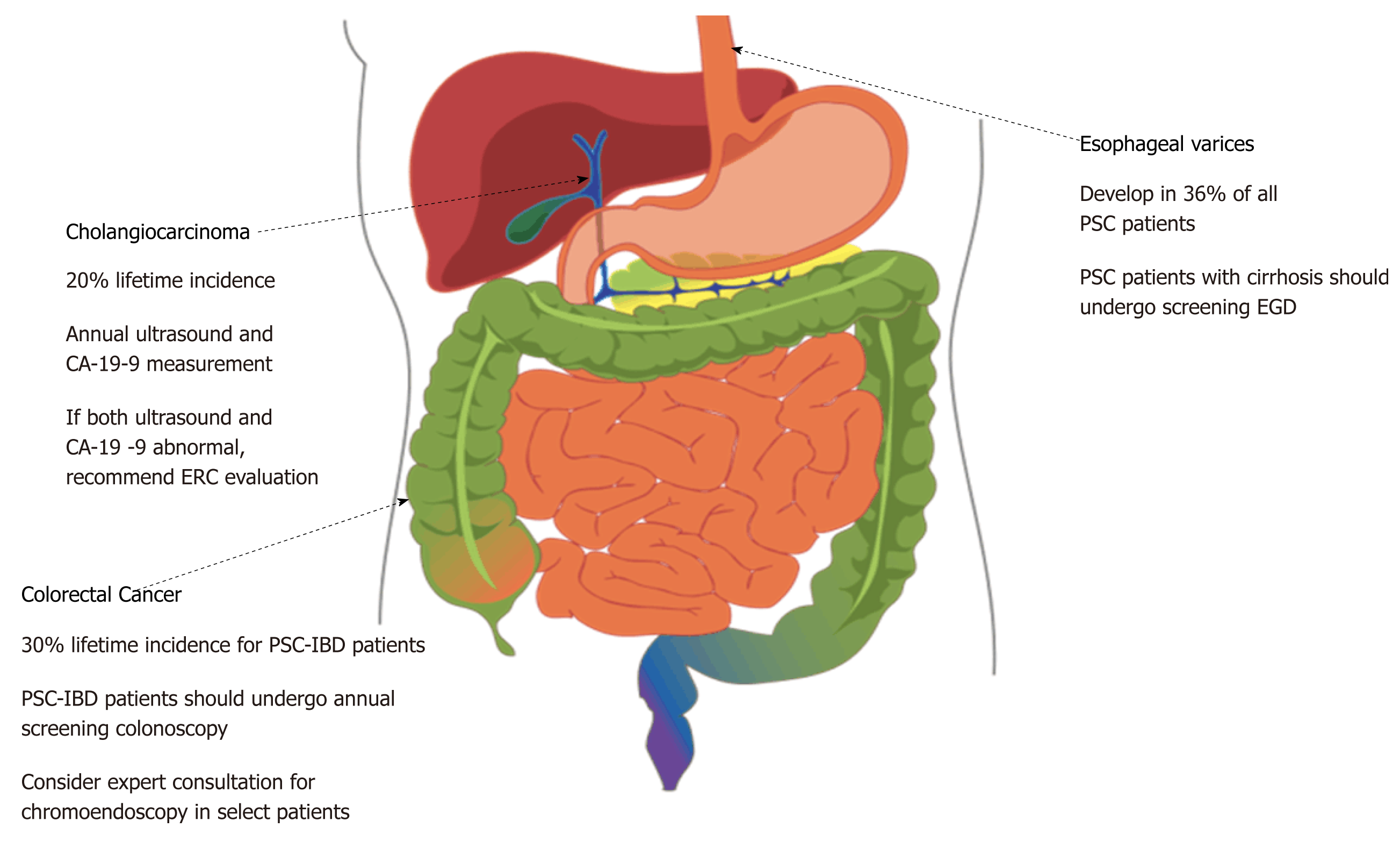 What Is The Icd 10 Code For Erosive Esophagitis