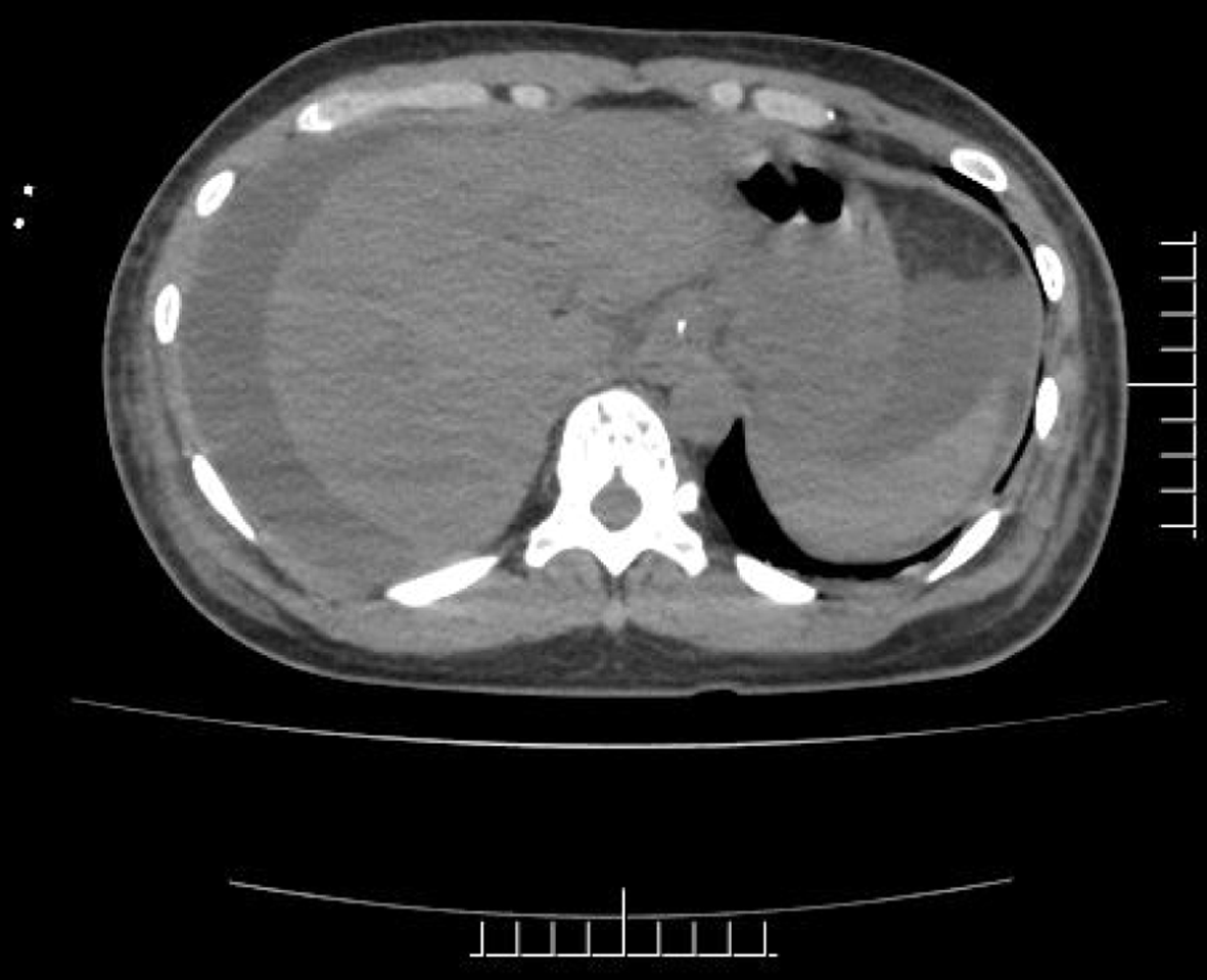 Figure 1 Figure 1