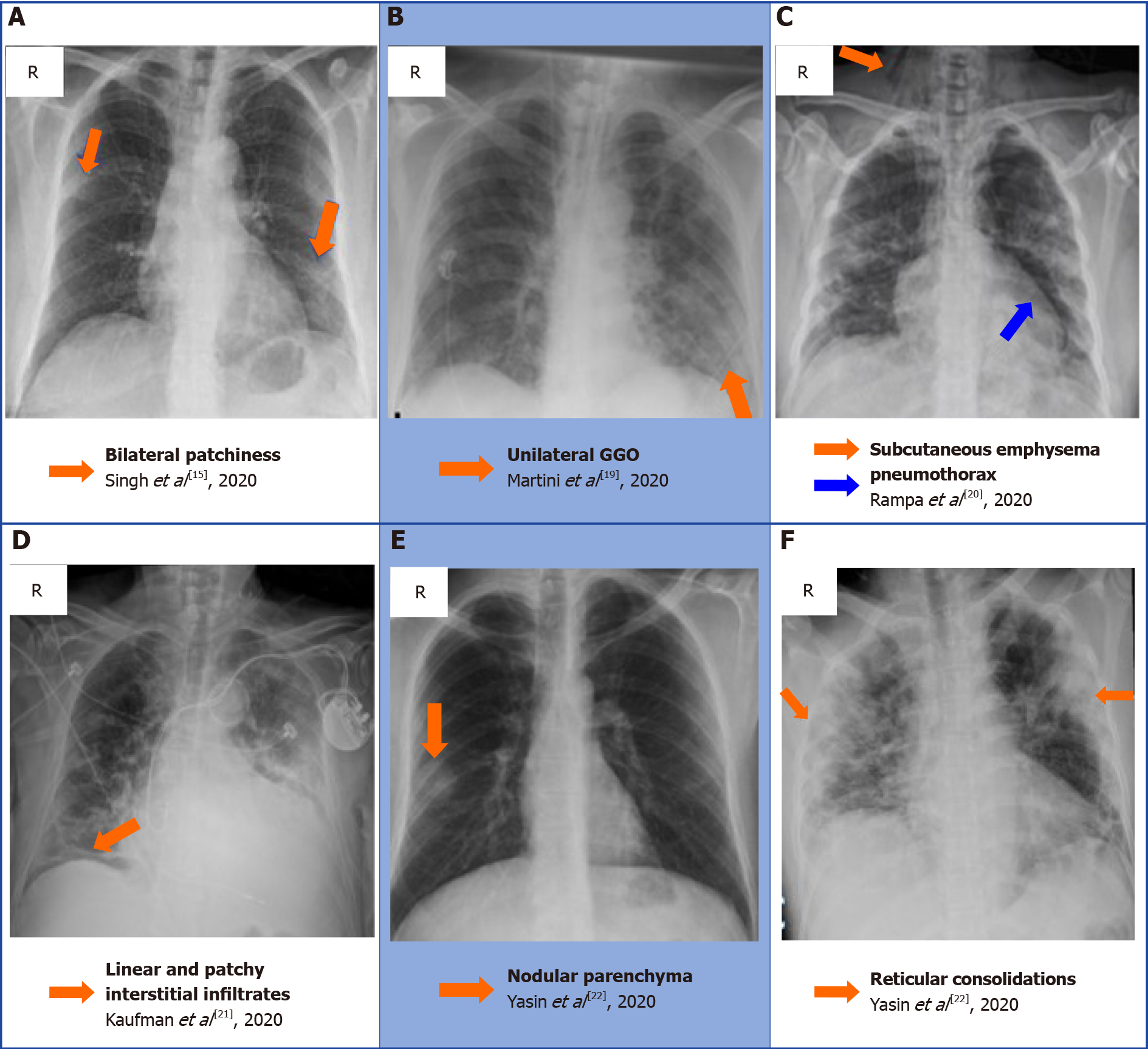 Comprehensive Literature Review On The Radiographic Findings Imaging 