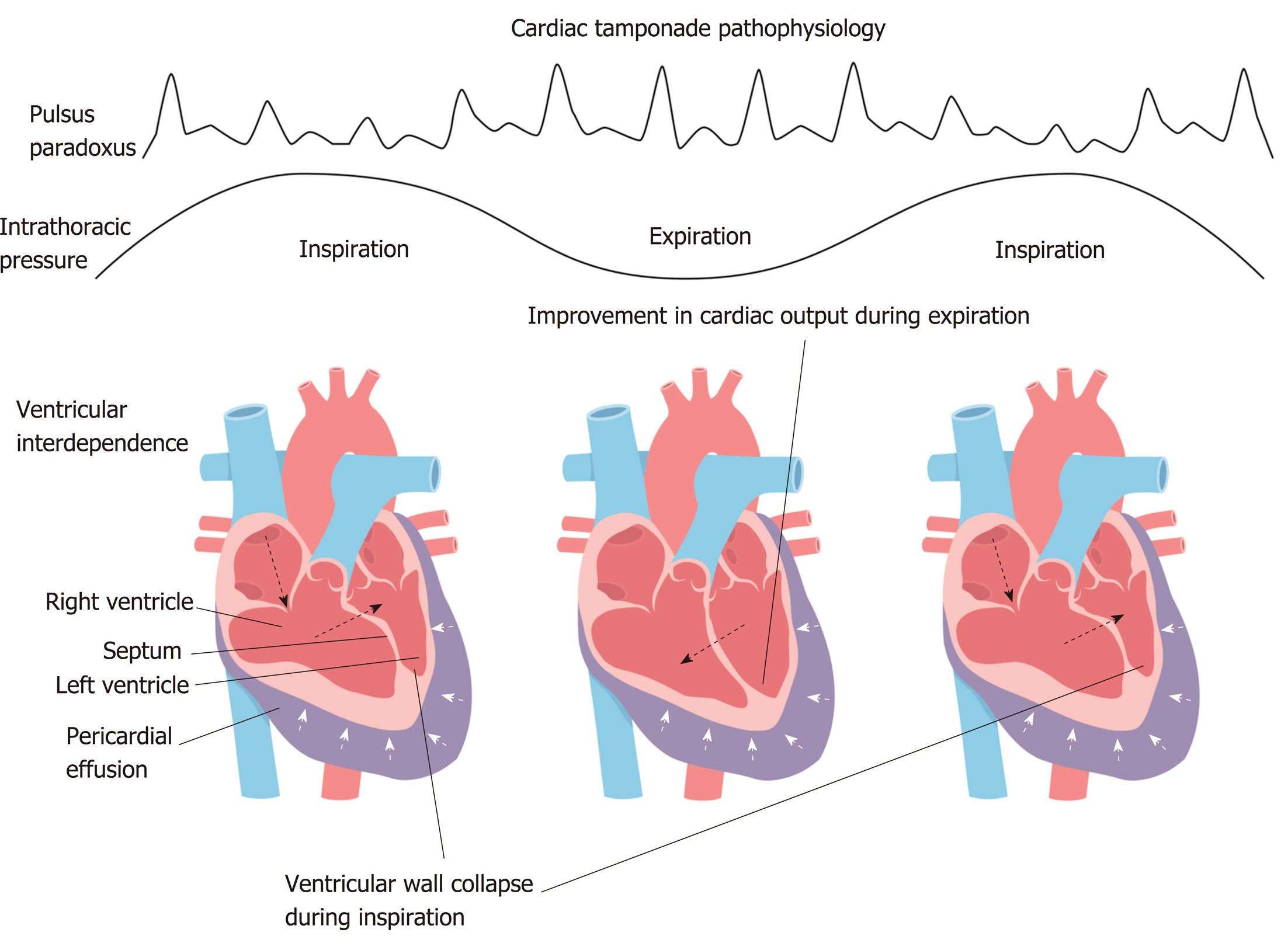 cardiac ipulse