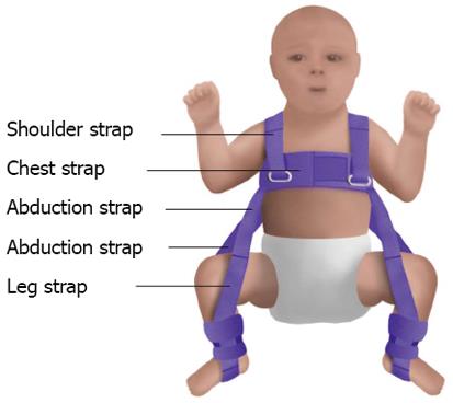 hip development in infants