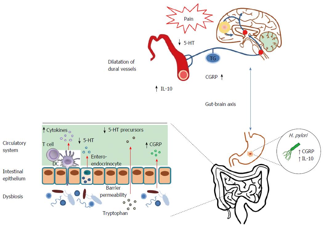 Gastrointestinal disorders associated with migraine: A comprehensive review