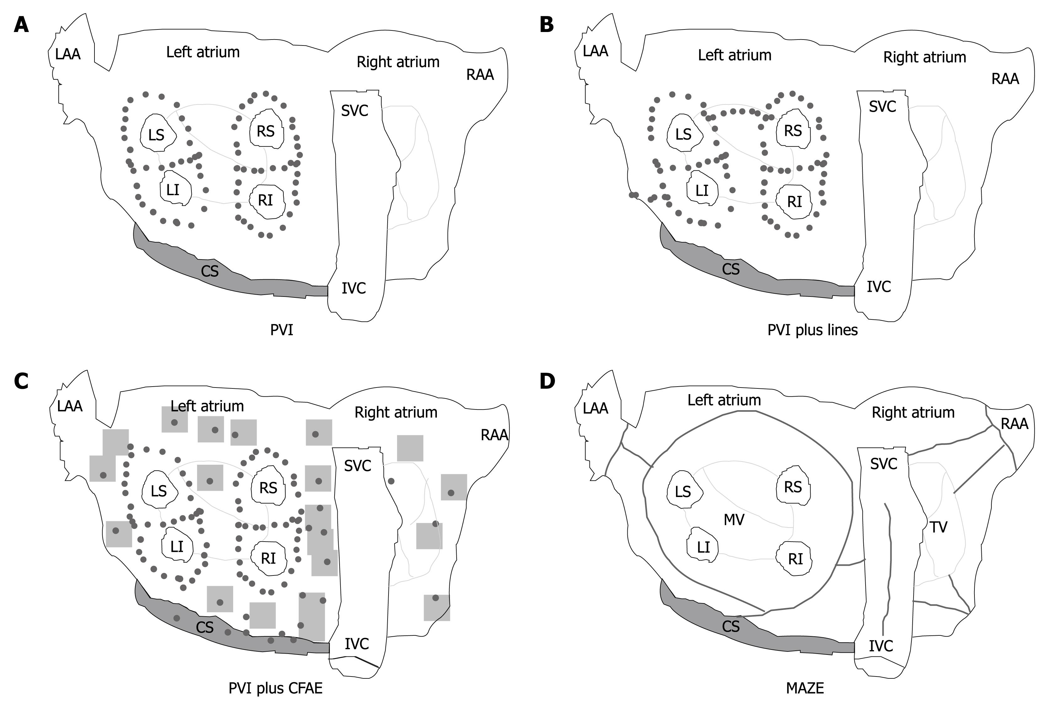 primary prevention atrial fibrillation ablation flutter