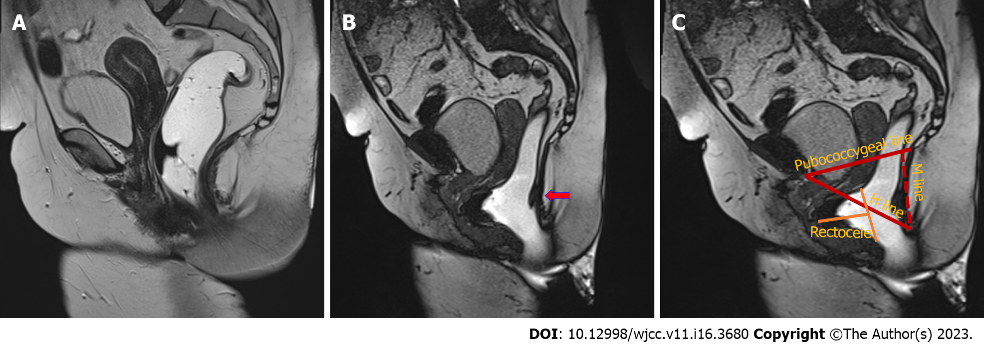 Current diagnostic tools and treatment modalities for rectal prolapse