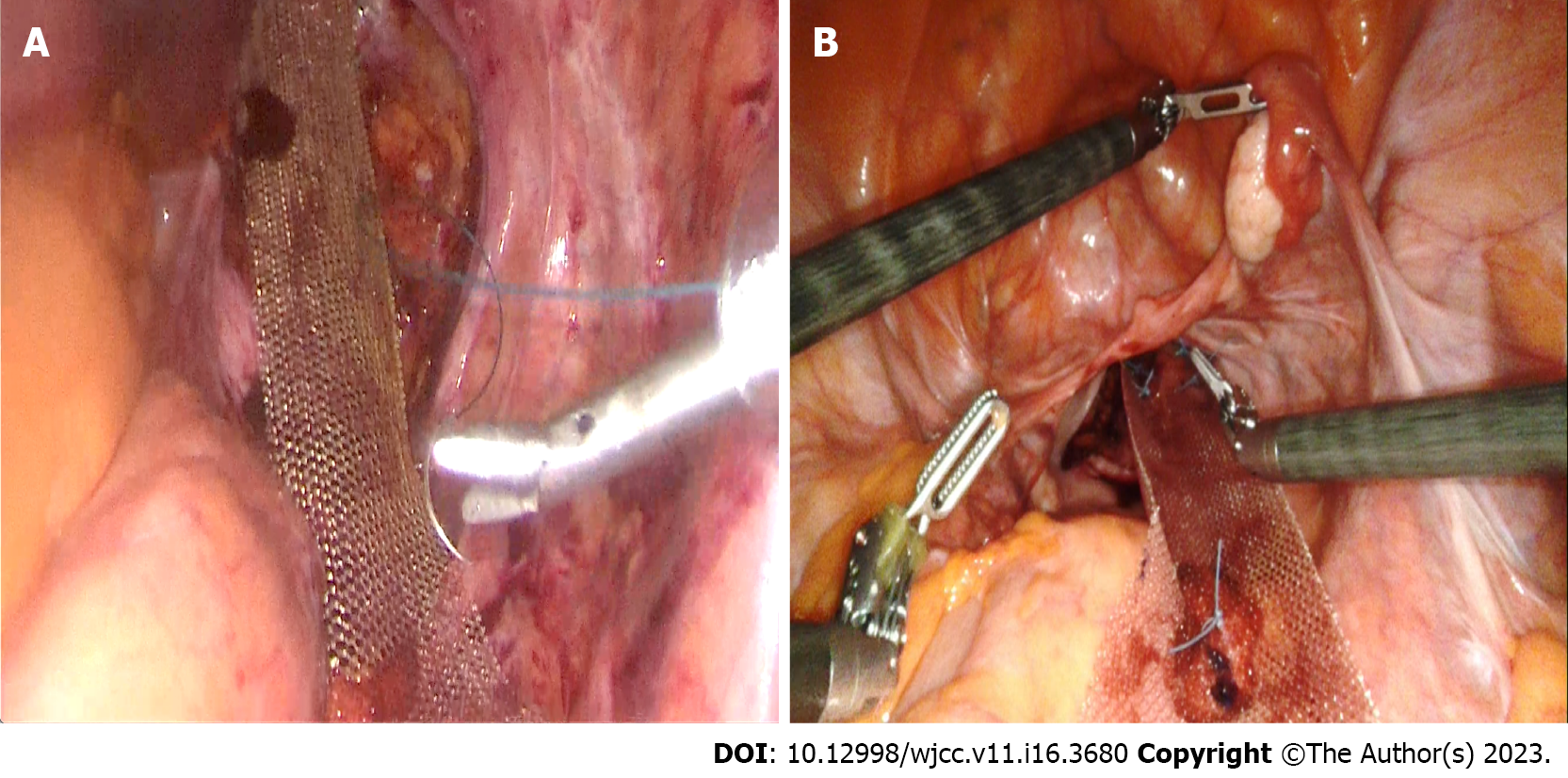 Current diagnostic tools and treatment modalities for rectal prolapse