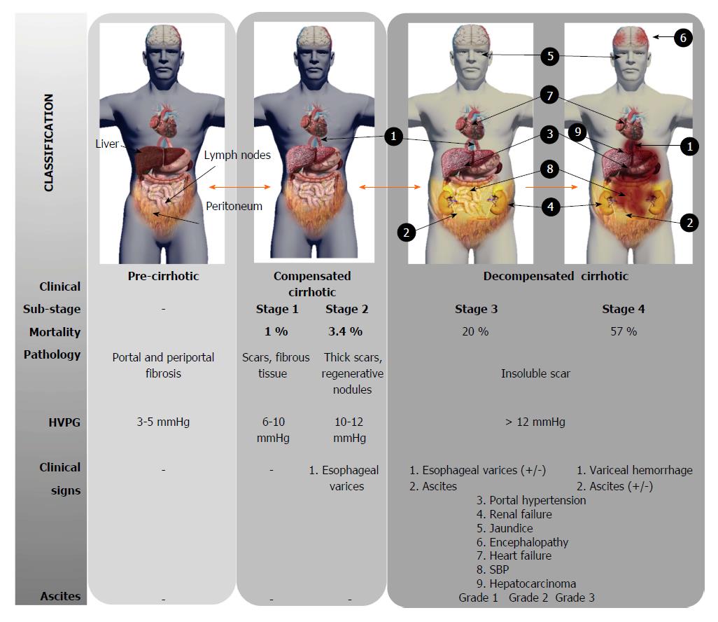 Inflammatory Status In Human Hepatic Cirrhosis