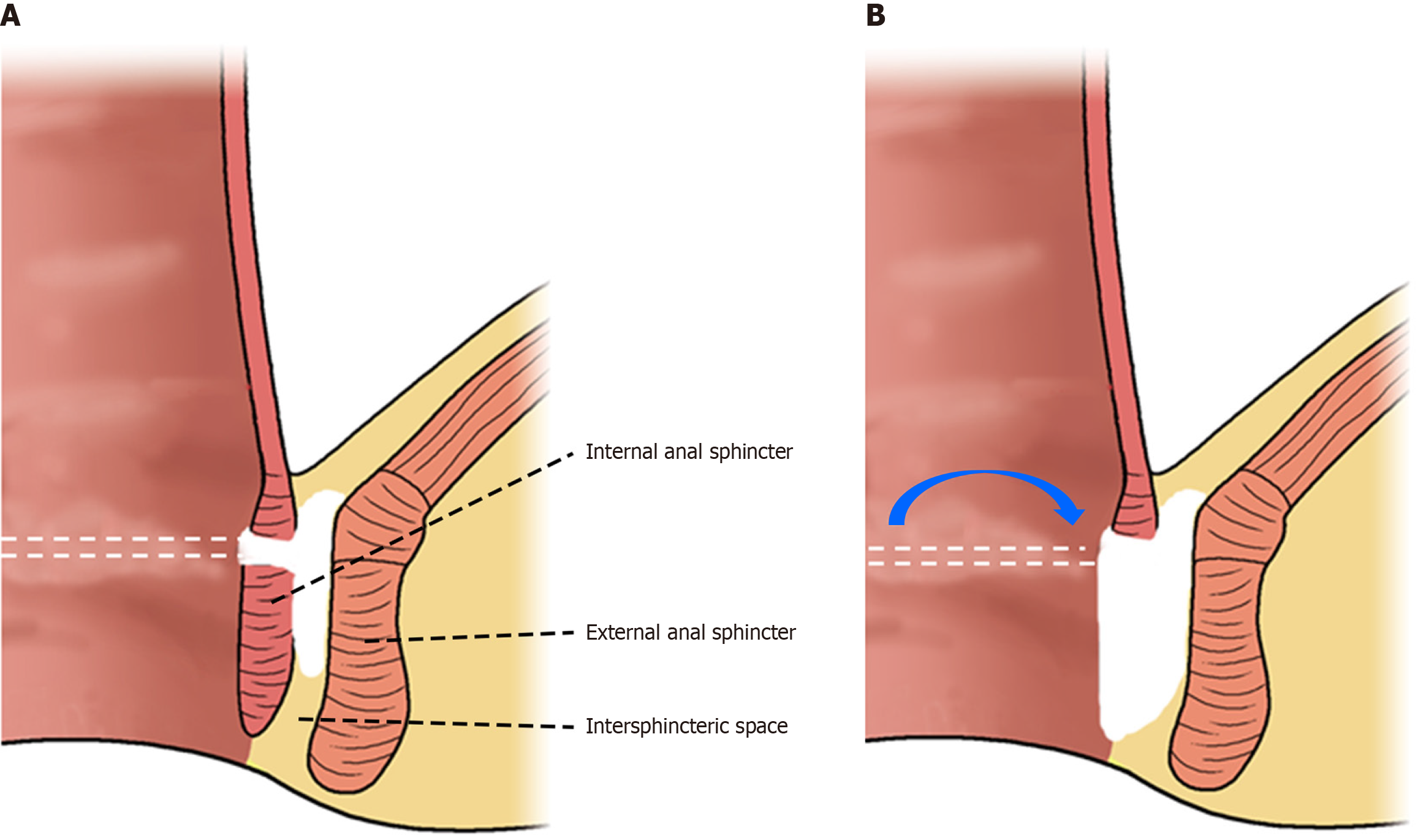 Figure 1 Figure 1