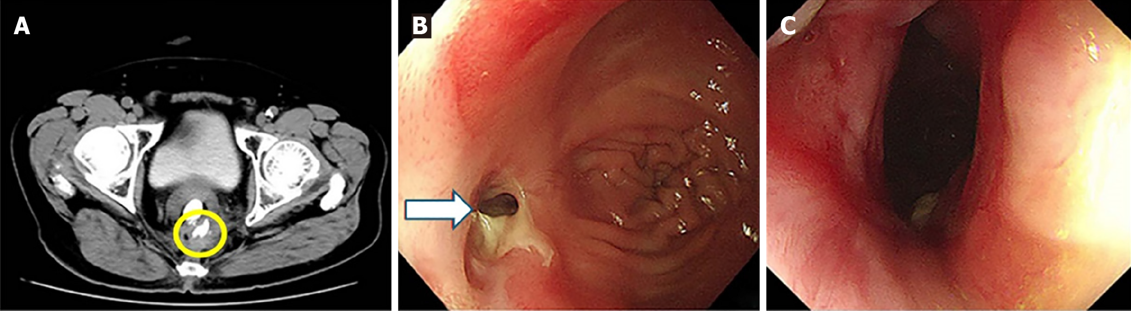 Figure 2 Figure 2