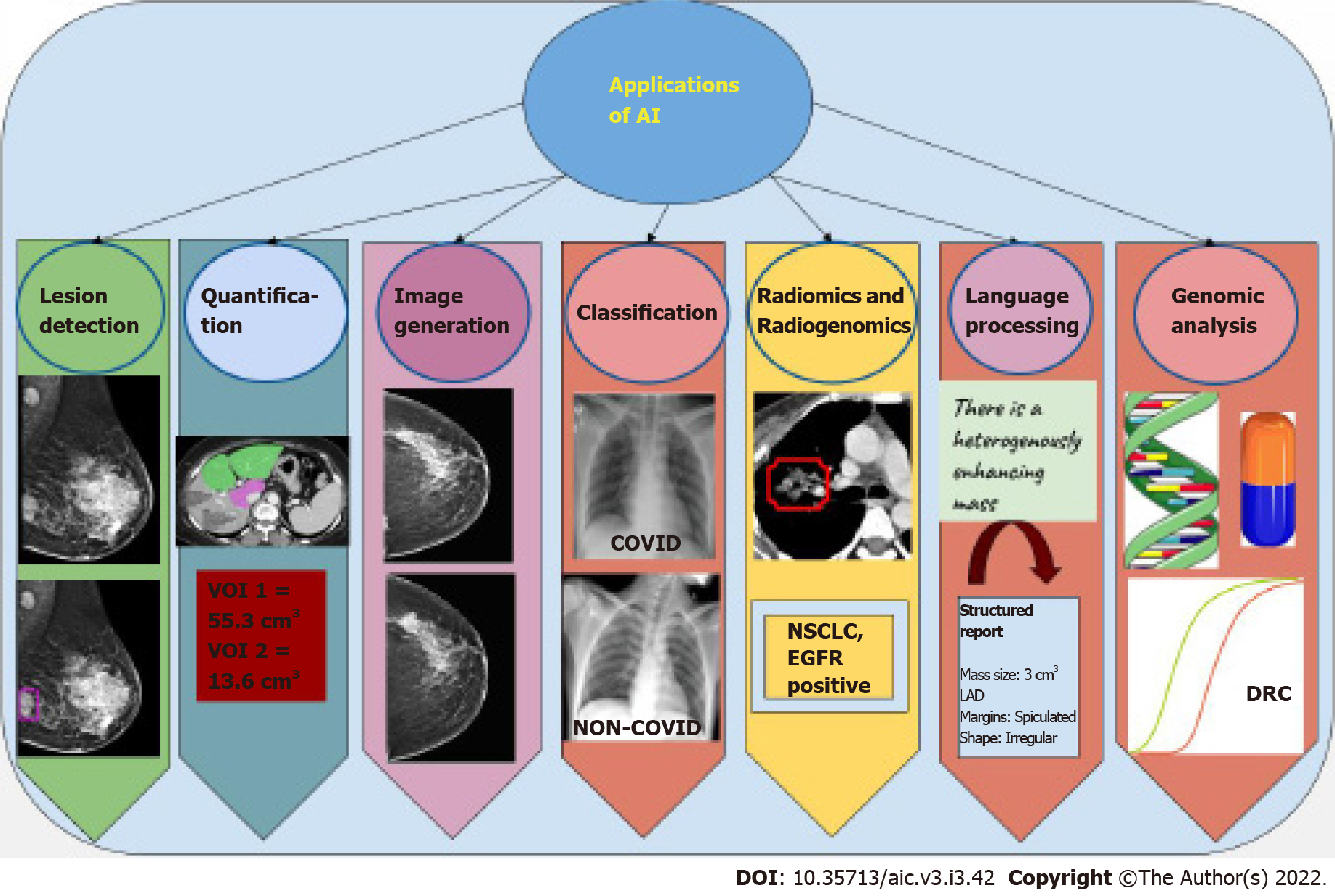 File:Mammogram showing small lesion.jpg - Simple English Wikipedia, the  free encyclopedia