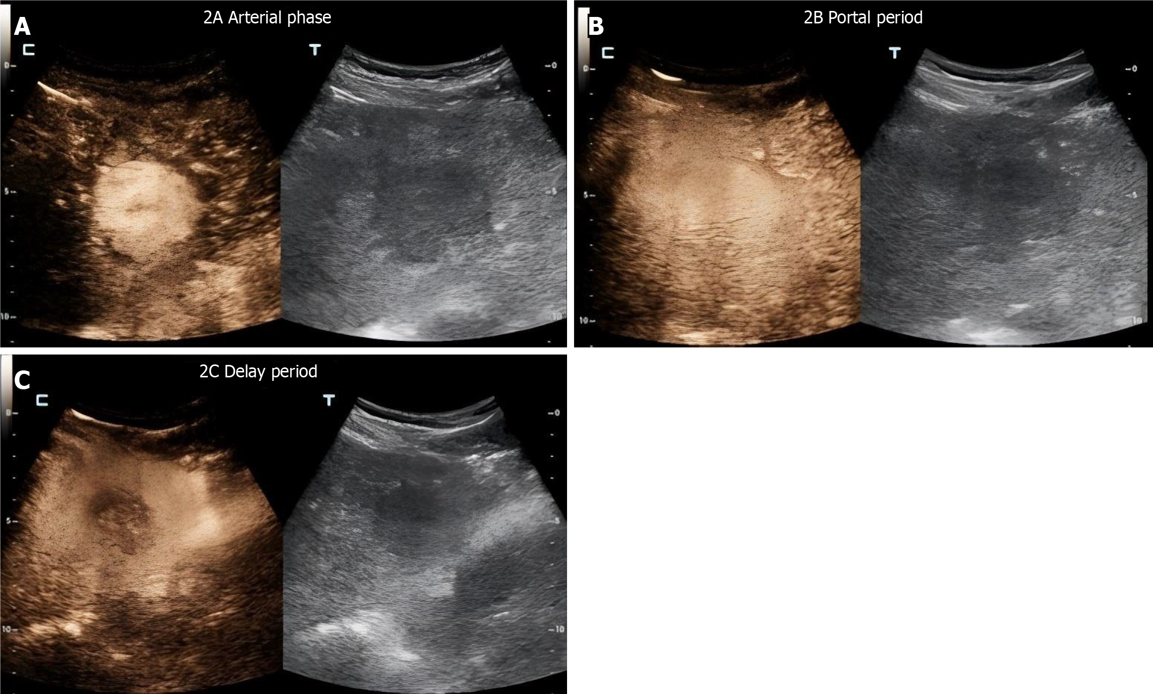 Figure 2 Figure 2