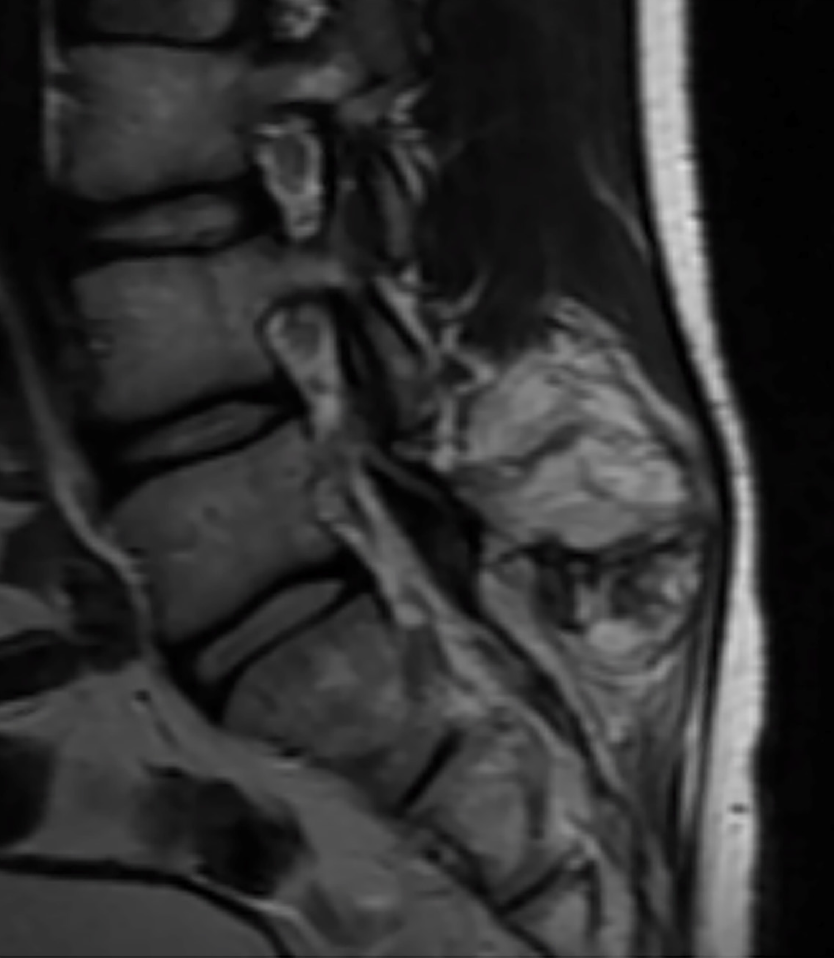 durere constantă la nivelul articulațiilor picioarelor coloana vertebrală umană coloana vertebrală cervicală