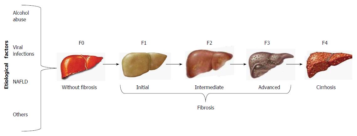 what is fibrosis of the liver